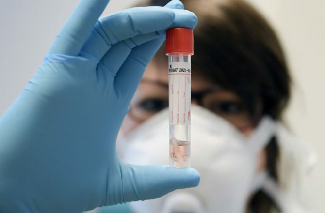 Минздрав Прикамья: какие бывают тесты на коронавирус, как проводятся и о чём говорят их результаты?